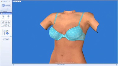 https://www.vabreastsurgery.com/wp-content/uploads/video/breastsculptor.jpg